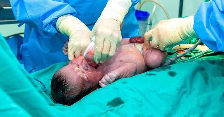 Arzt bringt ein gesundes Baby zur Welt – als er die Nabelschnur sieht, fordert er den Papa auf, ein Foto des ‚Wunders‘ zu machen