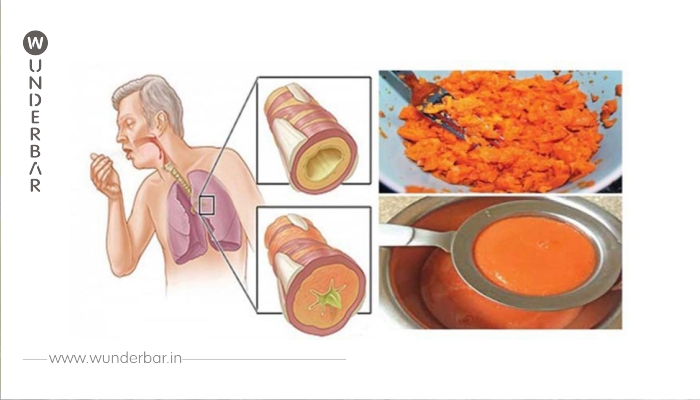 Dieser hausgemachte Sirup entfernt Schleim aus den Lungen und heilt Husten in kürzester Zeit!