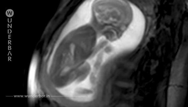 Magnet-Radiografie zeigt die Bewegungen des Ungeborenen – schau dir den Clip an, der Millionen fasziniert!