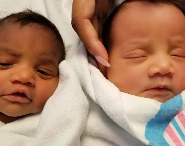 Die Mutter veröffentlicht Bilder von ihren Zwillingen – und alle sind über diesen Unterschied erstaunt