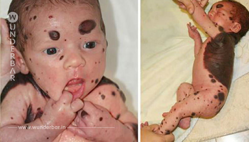 Baby wird mit blutigen Flecken geboren, Arzt offenbart, was keine Mutter hören möchte