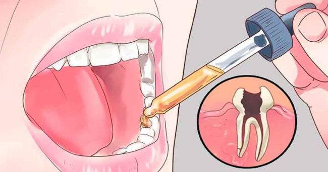 Natürliche Mittel gegen Zahnschmerzen, von denen Dein Zahnarzt nicht will, dass Du sie kennst
