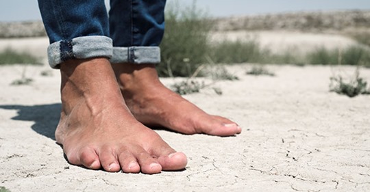 Plattfuß – ungesunde Fehlstellung des Fußes