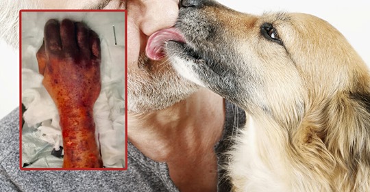 Hund leckt Herrchen durchs Gesicht – 63 Jähriger stirbt an Infektion