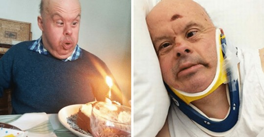 61 Jähriger mit Down Syndrom stirbt, nachdem Krankenhaus ihn 20 Tage ohne Essen allein ließ