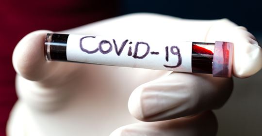 Coronavirus: Deutsches Labor muss 2.000 Tests wiederholen