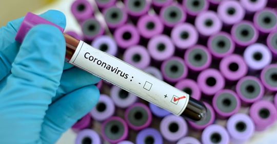 Coronavirus: Virologe Prof. Ulf Dittmer erklärt Umgang mit SARS-CoV-2