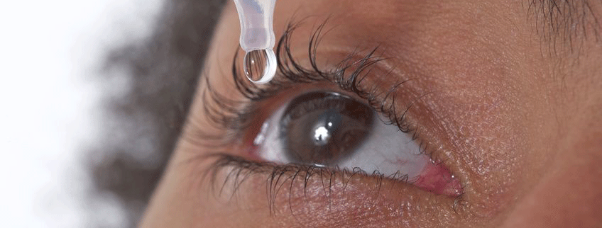 Feuchte Makula: Besser gewappnet gegen Sehverlust