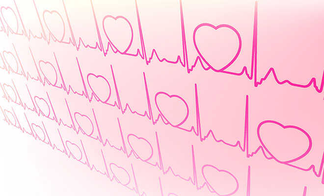 Elektrokardiogramm: Was ist eigentlich ein EKG?