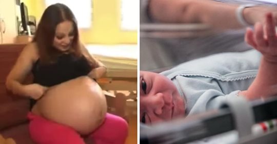 Ärzte im Kreißsaal wurden Zeugen der seltenen und historischen Geburt einer 23 jährigen Mutter