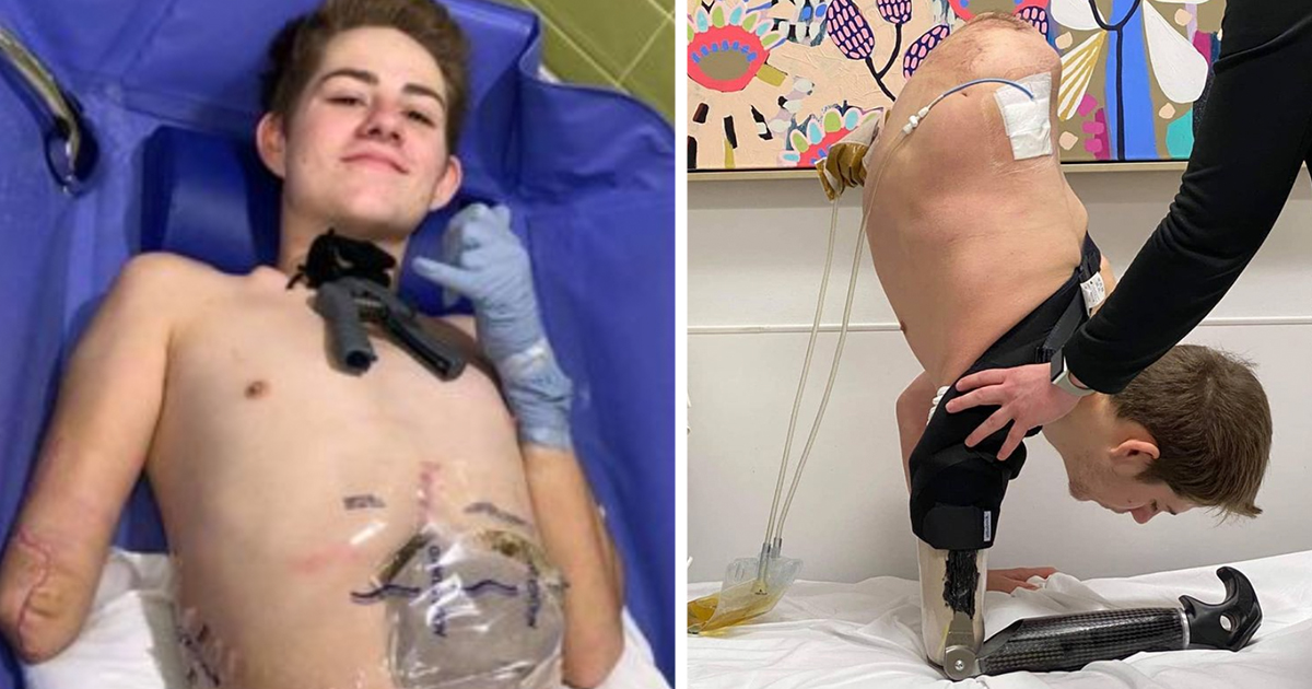 19-Jähriger wird von Gabelstapler zerquetscht, lässt sich unteren Körper amputieren – um sein Leben zu retten