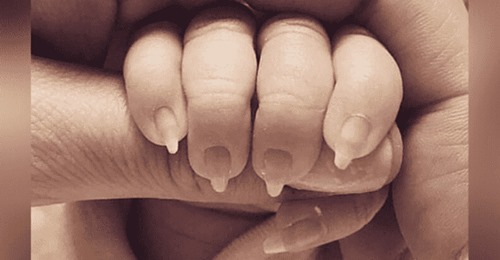 Eltern werden kritisiert, weil sie ihrem Baby eine Maniküre gegeben haben – Nägel wurden zu „Baby Klauen“