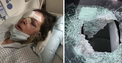 Krankenschwester & zweifache Mutter mit Stein durch Windschutzscheibe schwerverletzt