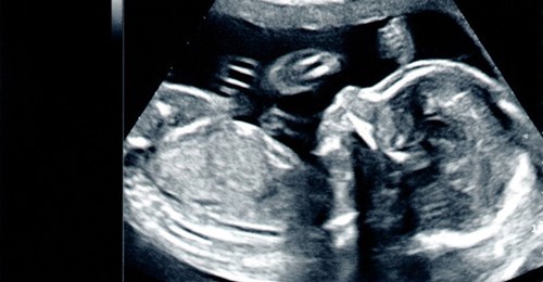 Wiener Grüne beantragen, mehr Abtreibungen durchzuführen