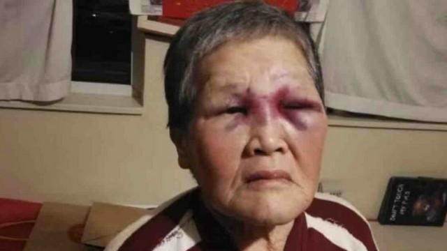 Ältere asiatische Frau (76) wird auf offener Straße angegriffen und schlägt zurück – Fälle häufen sich