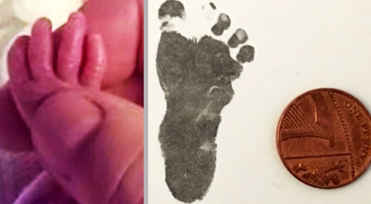 Francesca wurde schon in der 24. Woche geboren: Ihr Fuß war so groß wie eine 1 Cent Münze