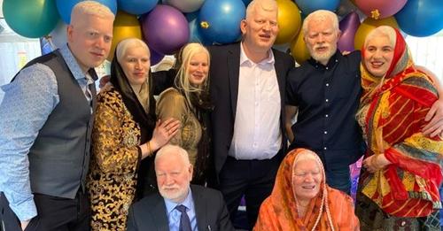 In dieser Familie sind alle sechs Geschwister Albinos: ein noch nie vorgekommener Rekord