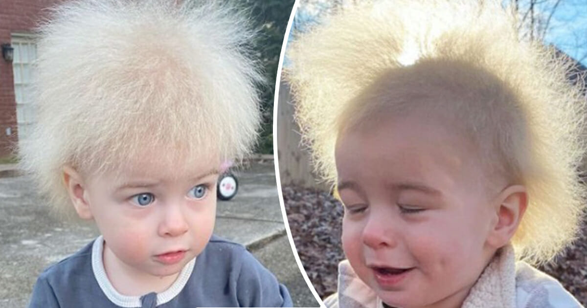 Kleiner Junge mit Struwwelpeter-Syndrom zaubert Lächeln auf die Gesichter der Menschen