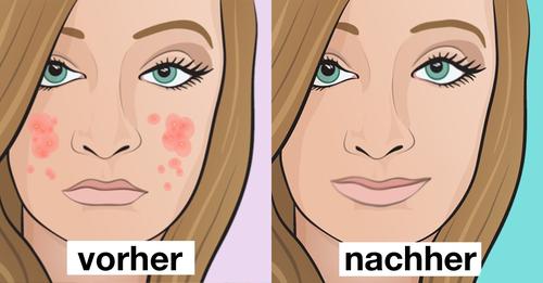 Gesichtsmaske selber machen: 4 Rezepte