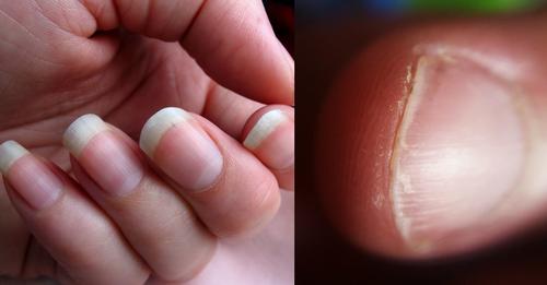 Fingernägel schneiden: 5 häufige Fehler